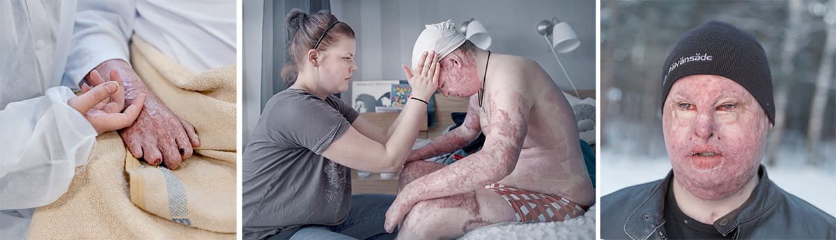  Foto: TOR JONSSON