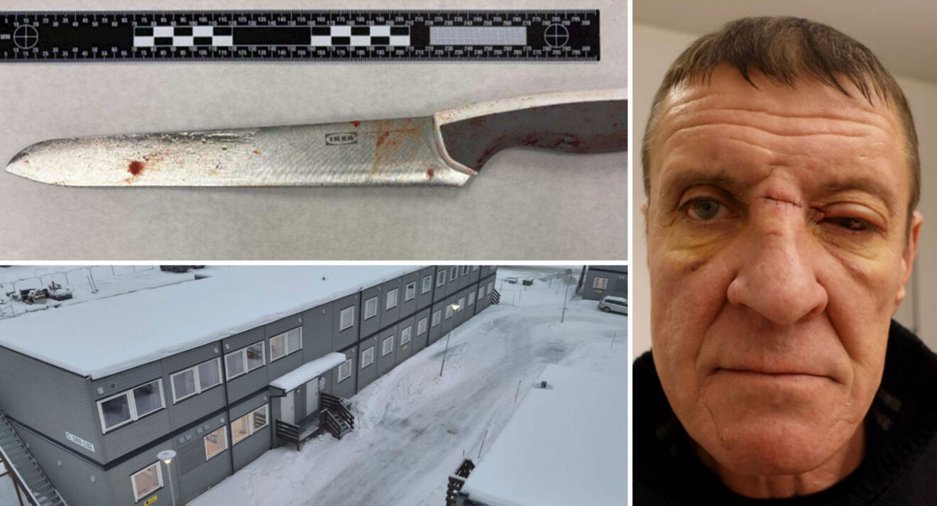 Knivhöggs och förlorade jobbet på Stegra: ”Väldigt svårt nu”